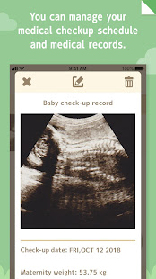 280days: Pregnancy Diary  Screenshots 5