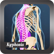 Recognize Kyphosis Disease  Icon