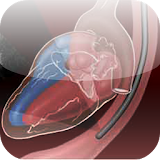 Echo Cardiography Info icon