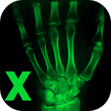 Xray Cam Real icon