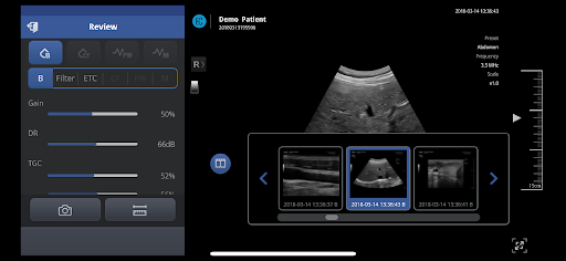 SONON X Basic Screen 3