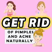 Get Rid of Pimples or Acne Naturally