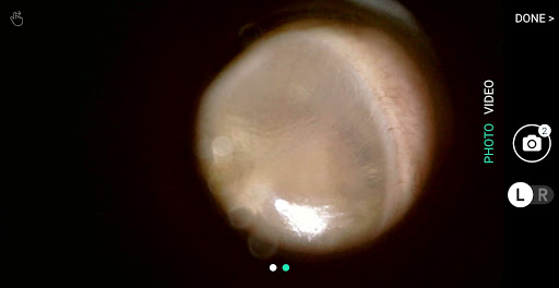 hearScope Screen 3