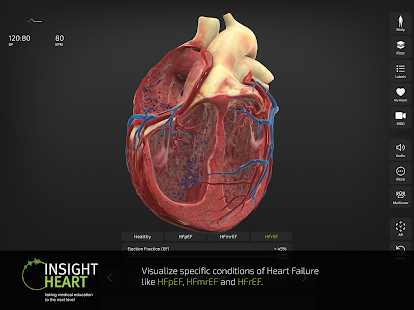 Pamje e ekranit INSIGHT HEART