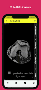 Radiology Anatomy CT And MRI