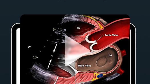 Point of Care Ultrasound Mod APK 1.0.3 (Unlocked) Gallery 10