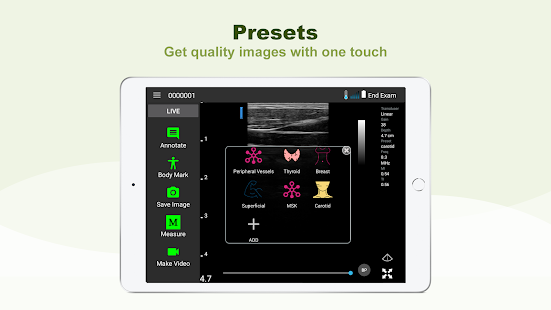 LELTEK Ultrasound - LeSono  Screenshots 3