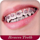 Braces Teeth Booth icon