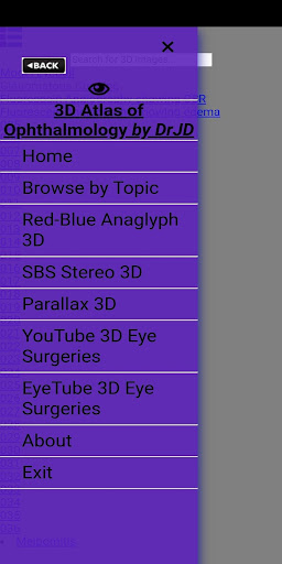 Android application 3D Atlas of Ophthalmology screenshort