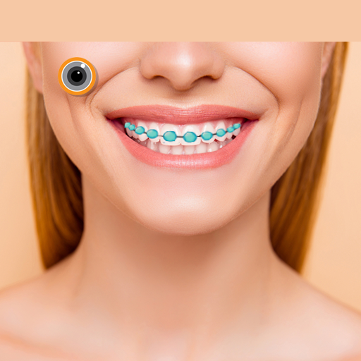 Braces Photo Editor logo