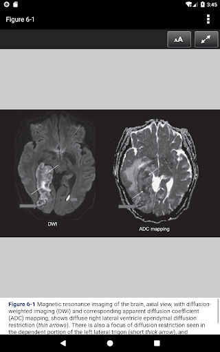 The NeuroICU Board Review
