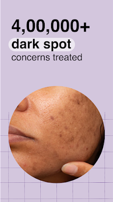 Cureskin: Skin & Hair Expertsのおすすめ画像4