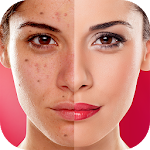 Cover Image of Download Face Blemishes Cleaner & Photo Scars Remover 1.3 APK