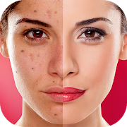 Face Blemishes Cleaner & Photo Scars Remover 1.1 Icon