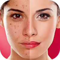 Face Blemishes Cleaner & Photo Scars Remover
