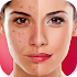 Face Blemishes Cleaner & Photo Scars Remover1.3
