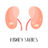 Kidney Stones and Treatment
