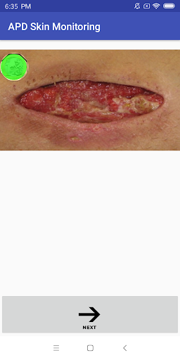 Android application APD Skin Monitoring App screenshort
