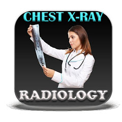 Chest  X-ray Radiology icon