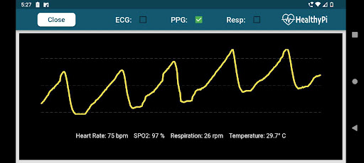 HealthyPi Screen 3