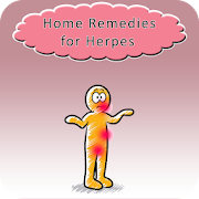 Home Remedies for Herpes