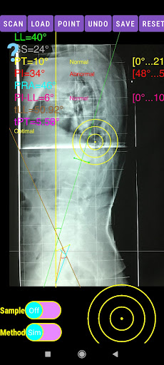Spinopelvic balance App Screen 3