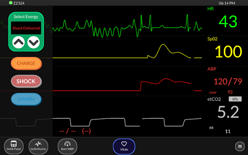 Simpl Patient Monitor screenshot 3