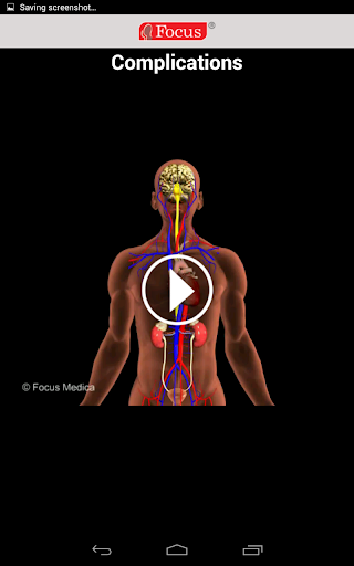 Complications of Hypertension