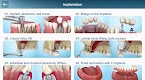 screenshot of Dental 3D Illustrations
