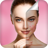 Pimple Remover: Photo Edit icon