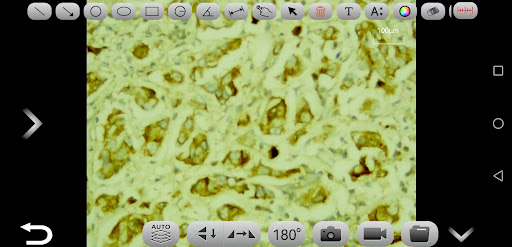 Topika Vision Screen 2
