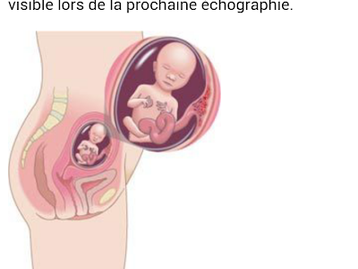 Image bebe a 17 semaines 205318-Bebe 15 semaines