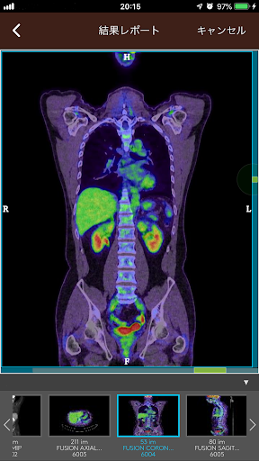 smart HIMEDIC Screen 2