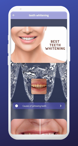 teeth whitening screenshot