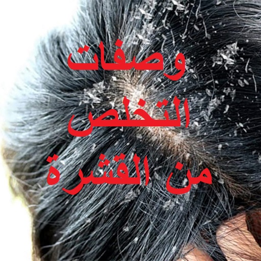 وصفات للتخلص من القشرة