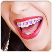 Teeth Braces Photo Booth