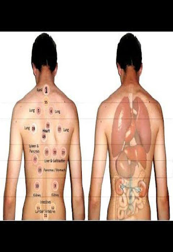 guide hijama