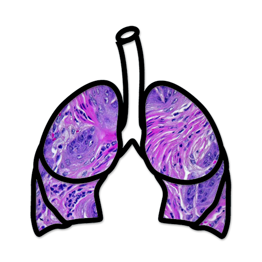 Lung Cancer Stage  Icon