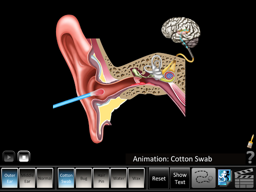 Android application Ear Disorders - Outer Middle screenshort