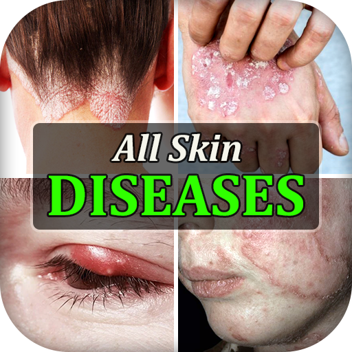 All Skin Diseases & Treatment logo