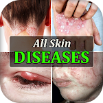 All Skin Diseases & Treatment Apk