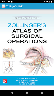 Zollinger Atlas of Surgery 11Eのおすすめ画像1