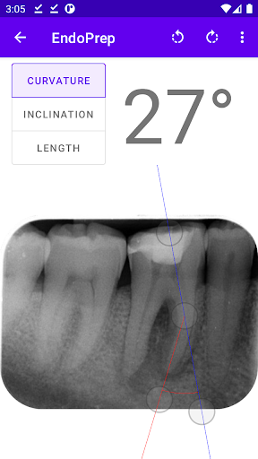 EndoPrep App Screen 2