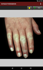 Captura de Pantalla 12 Fitzpatrick's Dermatology Flas android