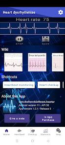Screenshot 1 Heart dysrhythmias android
