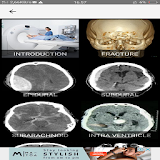 HEAD TRAUMA CT EVALUATION icon