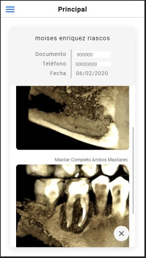 Radomax Screen 2