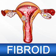 Top 27 Health & Fitness Apps Like Uterine Fibroid Causes Symptoms Types & Treatment - Best Alternatives