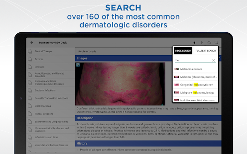 Dermatology DDx Ekran görüntüsü