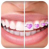 Braces App that look Real for Boys & Girls icon